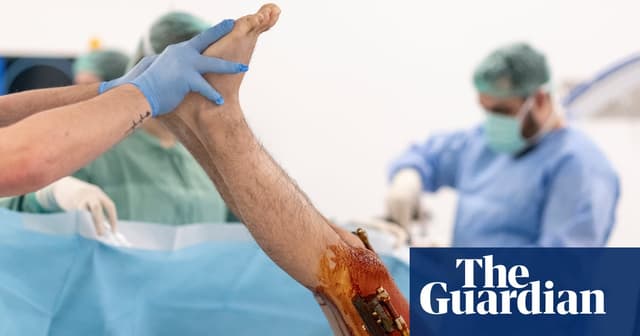 ‘Being short is a curse’: the men paying thousands to get their legs broken – and lengthened - Featured Image