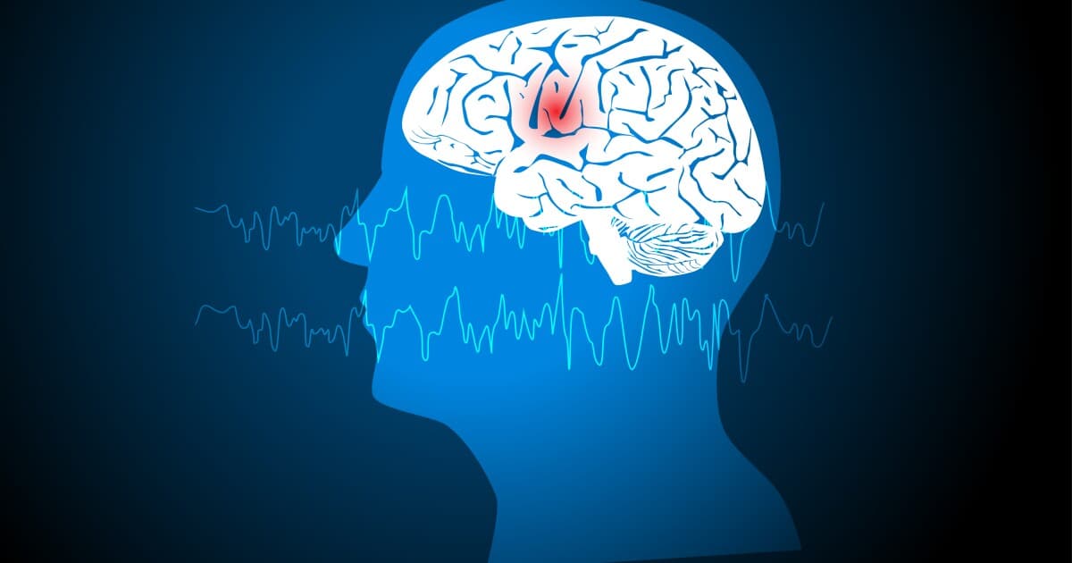 Promising new epilepsy drug delivers 80% reduction in seizures - Featured Image