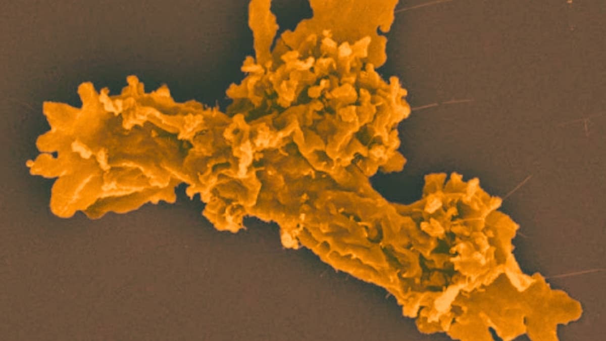 Extreme 'Fire Amoeba' Smashes Record For Heat Tolerance - Featured Image