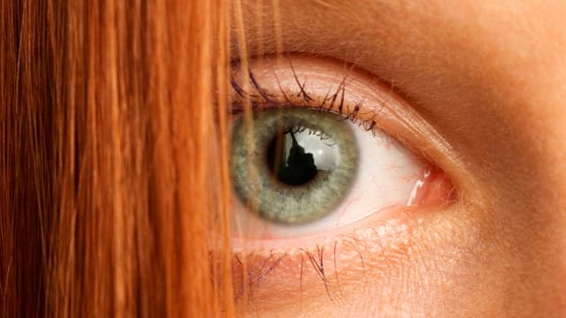 Red Hair Gene Could Explain Why Some Wounds Never Heal - Featured Image