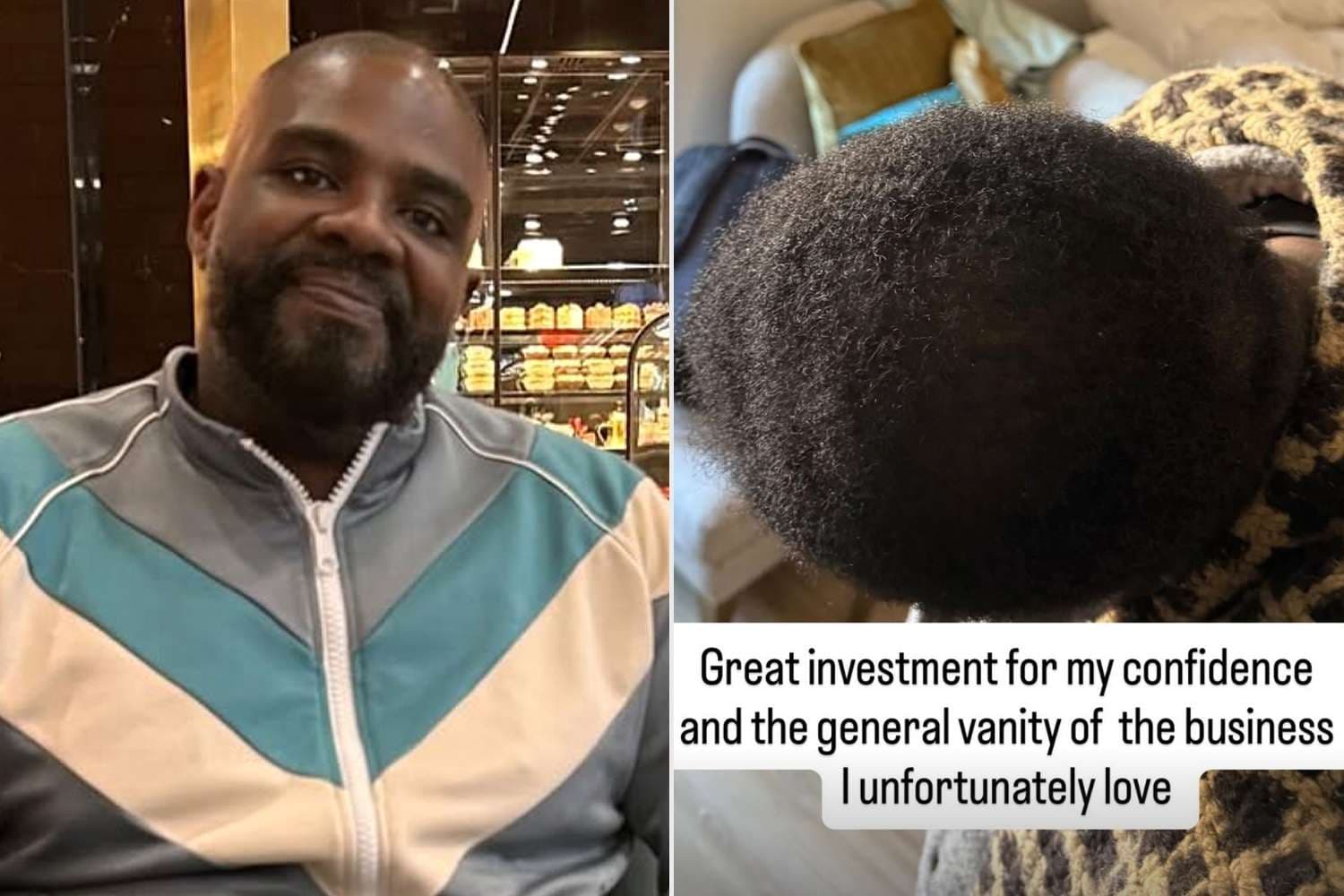 Comedian Ron Funches Reveals He Was in the 'Shedding Phase’ of Hair Transplant While Filming Traitors: 'Whoops' - Featured Image